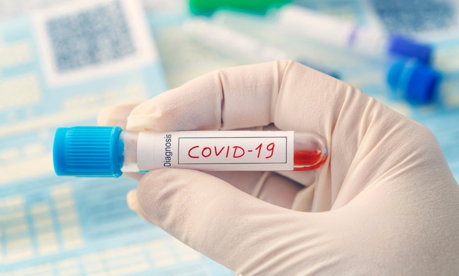ΕΚΠΑ: Νεότερα δεδομένα για την πρόγνωση των ασθενών με COVID-19