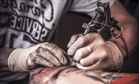 Αποζημιώνεται η «Αφαίρεση Τατουάζ» μέσα από τα συμβόλαια υγείας;