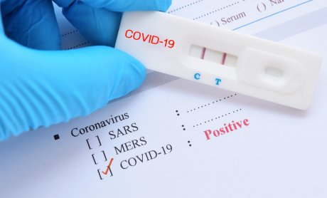 Τα επίμονα ψευδώς θετικά τεστ αντιγόνου Covid-19 σχετίζονται με την ύπαρξη αυτοάνοσων νοσημάτων!