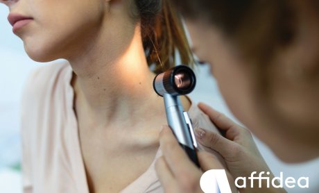 Affidea: Δερματοσκόπηση σπίλων - Η εξέταση για την έγκαιρη διάγνωση του καρκίνου του δέρματος!