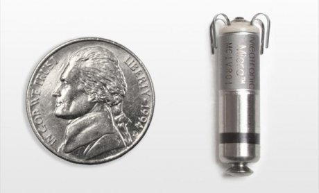 Ο πρώτος ασύρματος βηματοδότης στη Β. Ελλάδα εμφυτεύθηκε στο Διαβαλκανικό!