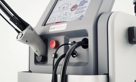 ΥΓΕΙΑ: Νέο υπερσύγχρονο μηχάνημα Laser θεραπείας Υπερτρίχωσης