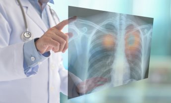 Αυξήθηκαν οι θάνατοι από φυματίωση κατά τη διάρκεια της πανδημίας COVID-19