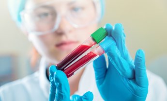Τεστ αίματος που ανιχνεύει 8 είδη καρκίνου ανέπτυξαν επιστήμονες, με επικεφαλής Έλληνα ογκολόγο!