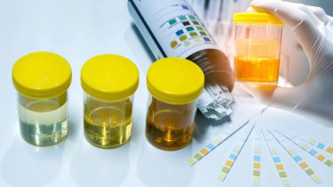 urine-test