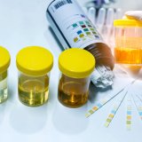 urine-test