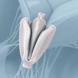 diadermiki_epidiorthosi_triglohinas
