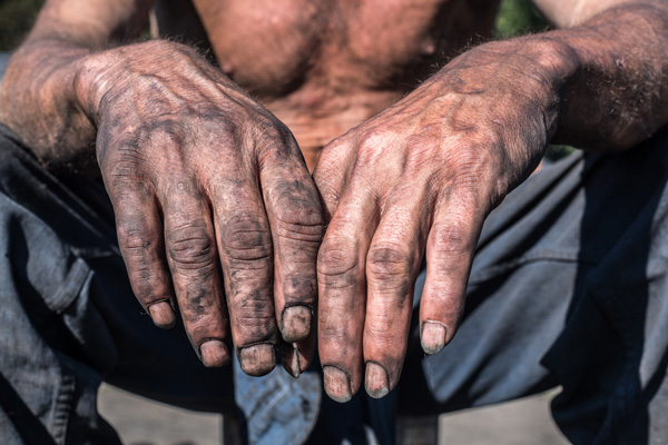 Τα χέρια του πατέρα μου και οι ασφαλιστές!