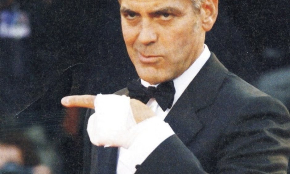 Τραυμάτισαν τα χερια της τσάντας!