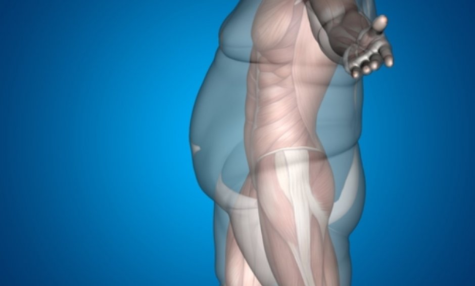 Τι είναι η βαριατρική χειρουργική και πως σας βοηθάει να χάσετε κιλά