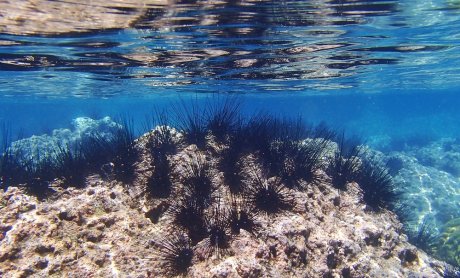 Τι να κάνετε εάν πατήσετε αχινό στις καλοκαιρινές διακοπές;