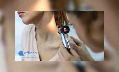 Δερματοσκόπηση σπίλων: Η εξέταση-κλειδί για την έγκαιρη ανίχνευση του καρκίνου του δέρματος!