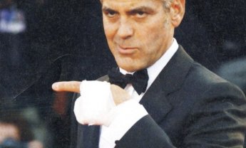 Τραυμάτισαν τα χερια της τσάντας!