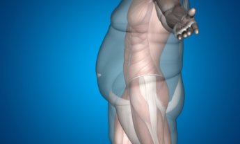 Τι είναι η βαριατρική χειρουργική και πως σας βοηθάει να χάσετε κιλά
