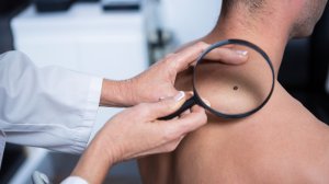 Δωρεάν εξετάσεις για μελάνωμα και καρκίνο του δέρματος