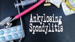 Αναγνωρίστε τα συμπτώματα της αγκυλοποιητικής σπονδυλαρθρίτιδας για να την αντιμετωπίσετε έγκαιρα!