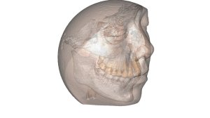 Η ζωή είναι 3D. Τώρα, είναι και η χειρουργική μόνο στο Metropolitan
