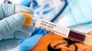 Κορονοϊός: 4 νέα κρούσματα και 2882 συνολικά - Στους 172 οι νεκροί