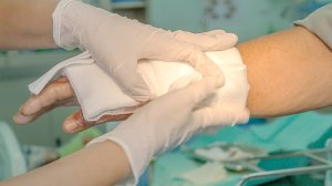 Οι πρώτες βοήθειες για τα εγκαύματα από φωτιά! Συμβουλές από το δερματολόγο Χρήστο Στάμου.