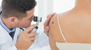 Αποζημιώνει το ασφαλιστήριο υγείας αφαίρεση σπίλων από το δέρμα;