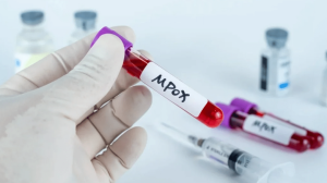 Συναγερμός στην Ευρώπη για την mpox – Σε εγρήγορση ο ΕΟΔΥ – Πως μεταδίδεται και ποιοι κινδυνεύουν!