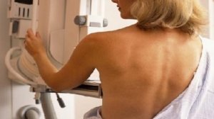 Δωρεάν μαστογραφίες για ανασφάλιστες στο Δήμο Αθηναίων