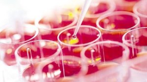 AIDS: νέα θεραπεία