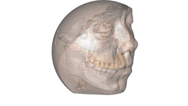 3d-plastiki