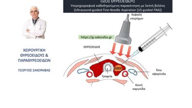 ozoi-thyreoeidoys-kai-parakentisi-me-lepti-veloni-fna.-ti-einai-pos-ginetai